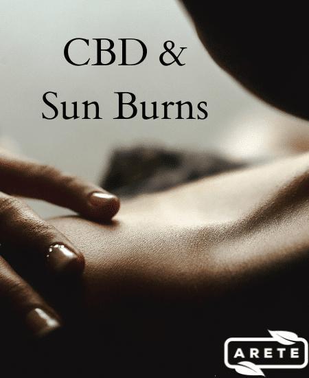 CBD and Sun Burns Image